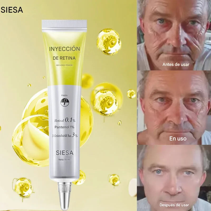 Crema Facial Antiarrugas con Retinol – Reafirma, Ilumina e Hidrata