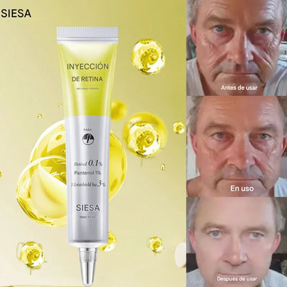 Crema Facial Antiarrugas con Retinol – Reafirma, Ilumina e Hidrata