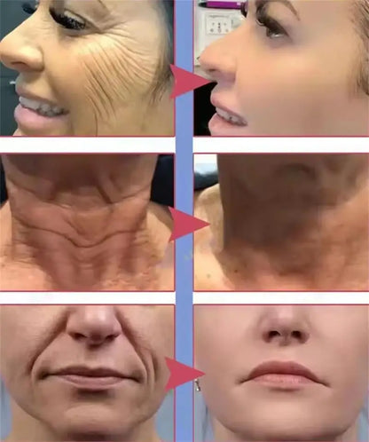 Crema Facial Antiarrugas con Retinol – Reafirma, Ilumina e Hidrata