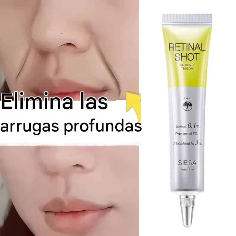 Crema Facial Antiarrugas con Retinol – Reafirma, Ilumina e Hidrata