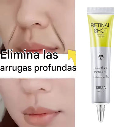 Crema Facial Antiarrugas con Retinol – Reafirma, Ilumina e Hidrata